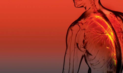 3 Φυτά με αποδεδειγμένη δράση στον μυοσκελετικό πόνο